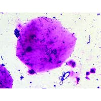 Bacteria